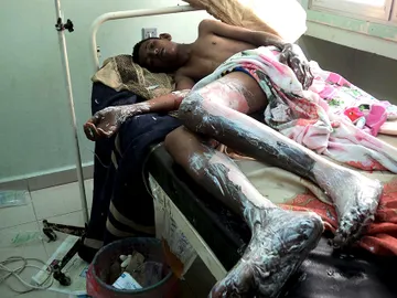Un herido en la explosión en Yemen Un herido en la explosión en Yemen