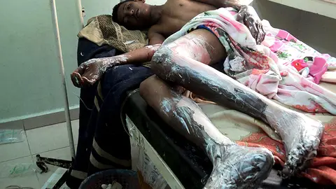 Un herido en la explosión en Yemen Un herido en la explosión en Yemen