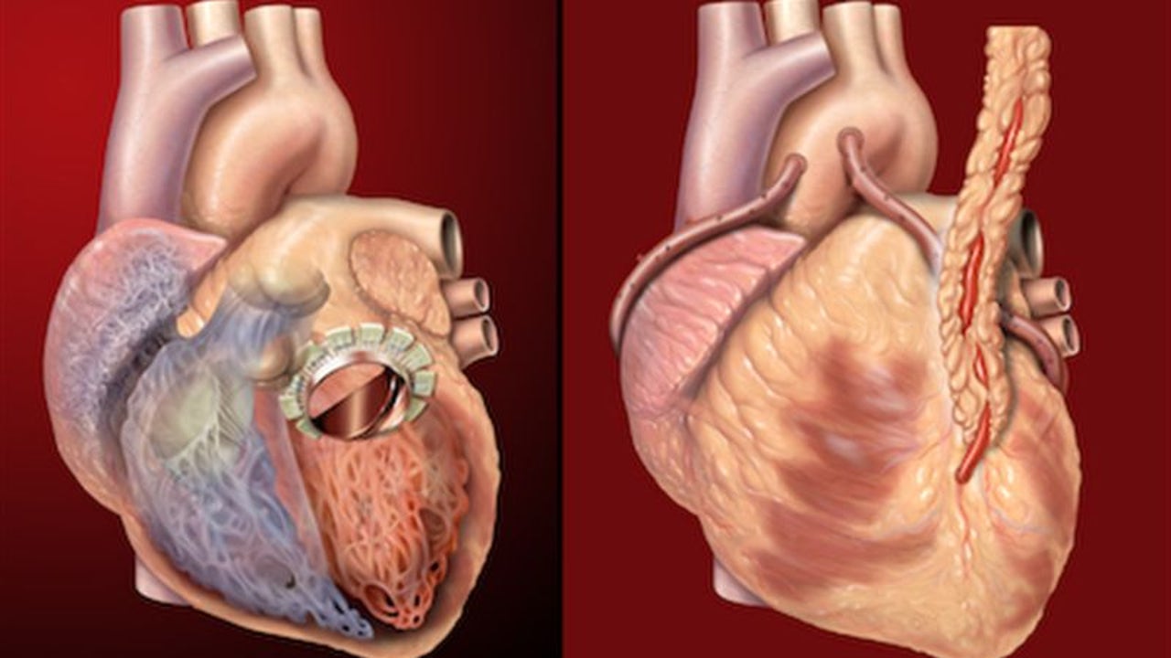 Первый порок сердца