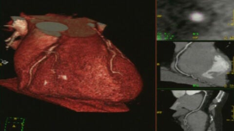 Crean un coraz&oacute;n con c&eacute;lulas madre