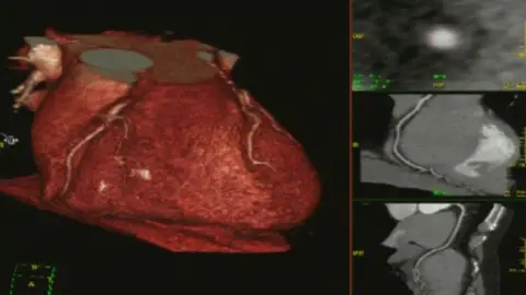 Crean un corazón con células madre Crean un corazón con células madre