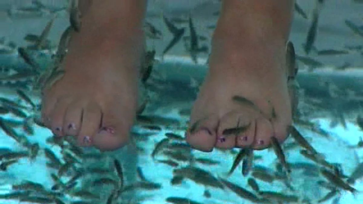 Ver para creer: pierde todos los dedos del pie tras un tratamiento con peces