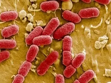 Imágenes de la bacteria 'E. Coli' Imágenes de la bacteria 'E. Coli'