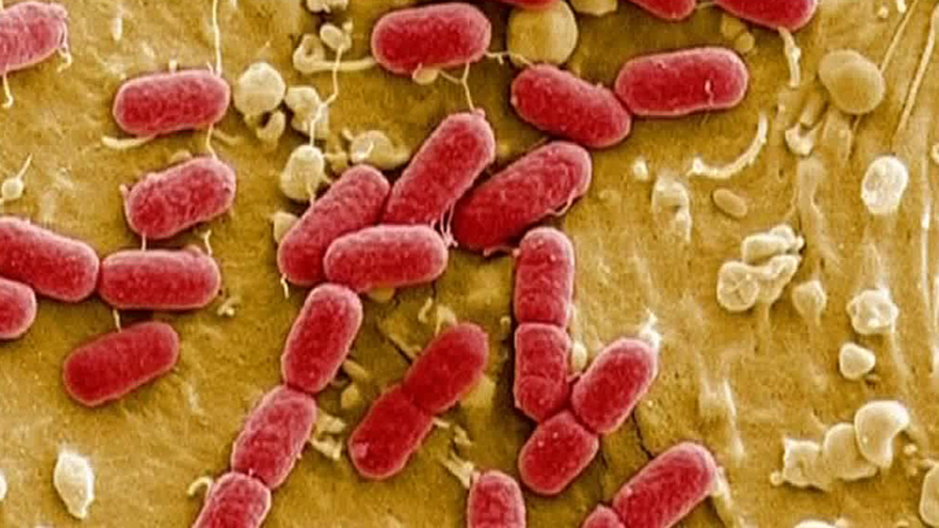 Imágenes de la bacteria 'E. Coli' Imágenes de la bacteria 'E. Coli'