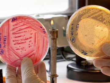 Francia desvincula la infección de E. Coli de Alemania Francia desvincula la infección de E. Coli de Alemania