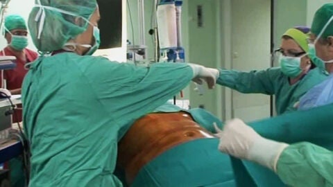 Reducci&oacute;n de est&oacute;mago de una menor.