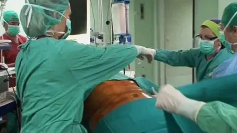 Reducción de estómago de una menor. Reducción de estómago de una menor.