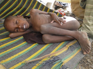 La ONU declara a Somalia en situación de 'hambruna'