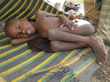 La ONU declara a Somalia en situación de 'hambruna' La ONU declara a Somalia en situación de 'hambruna'
