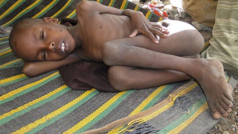 La ONU declara a Somalia en situaci&oacute;n de 'hambruna'