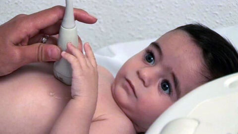 David el beb&eacute; operado con &eacute;xito dentro del vientre de su madre