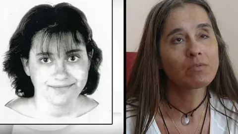 Una joven se queda ciega al operarse de miopía Una joven se queda ciega al operarse de miopía