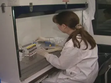 La OMS trabaja para frenar el alarmante incremento de tuberculosis en Europa La OMS trabaja para frenar el alarmante incremento de tuberculosis en Europa