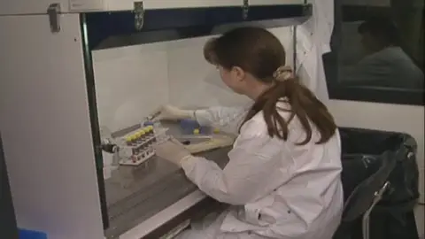 La OMS trabaja para frenar el alarmante incremento de tuberculosis en Europa La OMS trabaja para frenar el alarmante incremento de tuberculosis en Europa