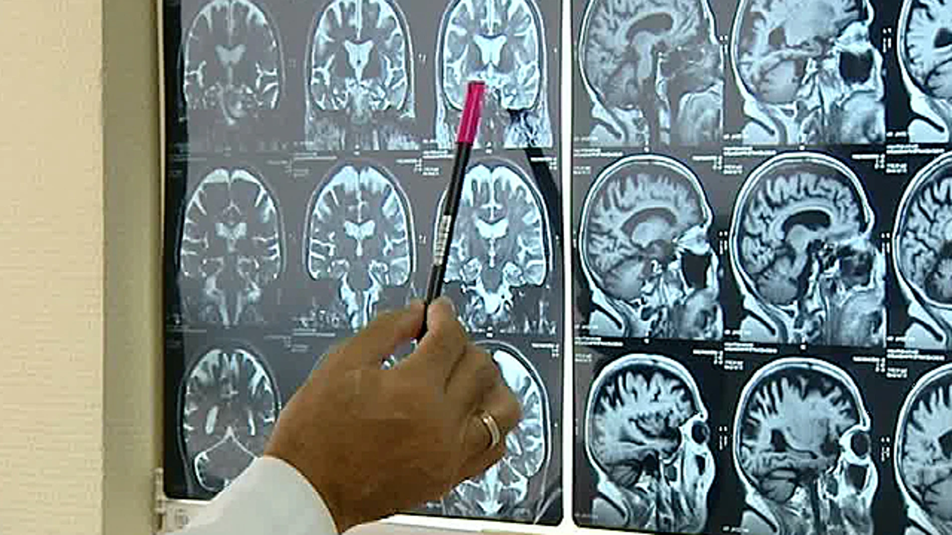 Radiografías del cerebro Radiografías del cerebro