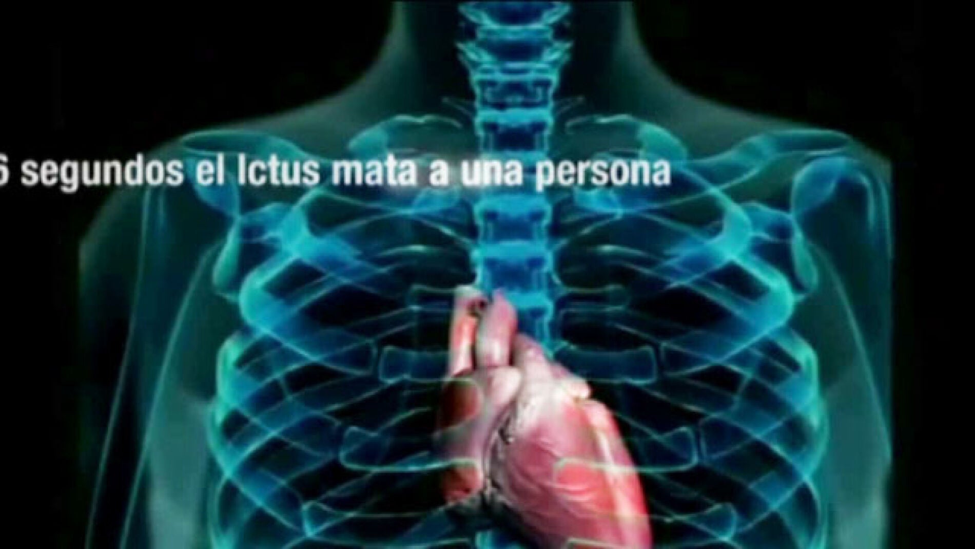 El ictus es la principal causa de muerte en nuestro pa&iacute;s.