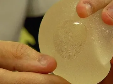 Un médico muestra una prótesis mamaria Un médico muestra una prótesis mamaria
