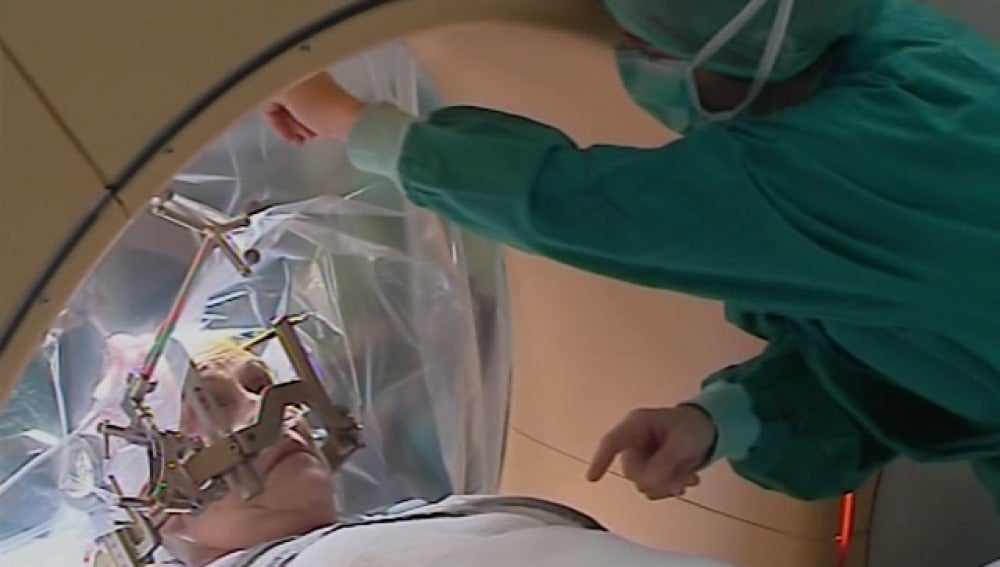 Operación a enfermos de Parkinson
