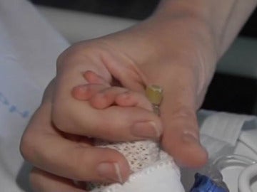 Un bebe trasladado con un corazón artificial Un bebe trasladado con un corazón artificial