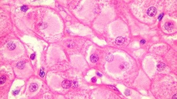 Hepatocitos o células hepáticas