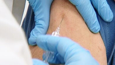 Sólo en la Comunidad Valenciana se han registrado más de 500 contagios de sarampión en los últimos tres meses
