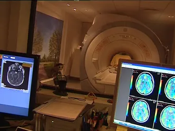 Pruebas para la detección del Alzheimer. Pruebas para la detección del Alzheimer.