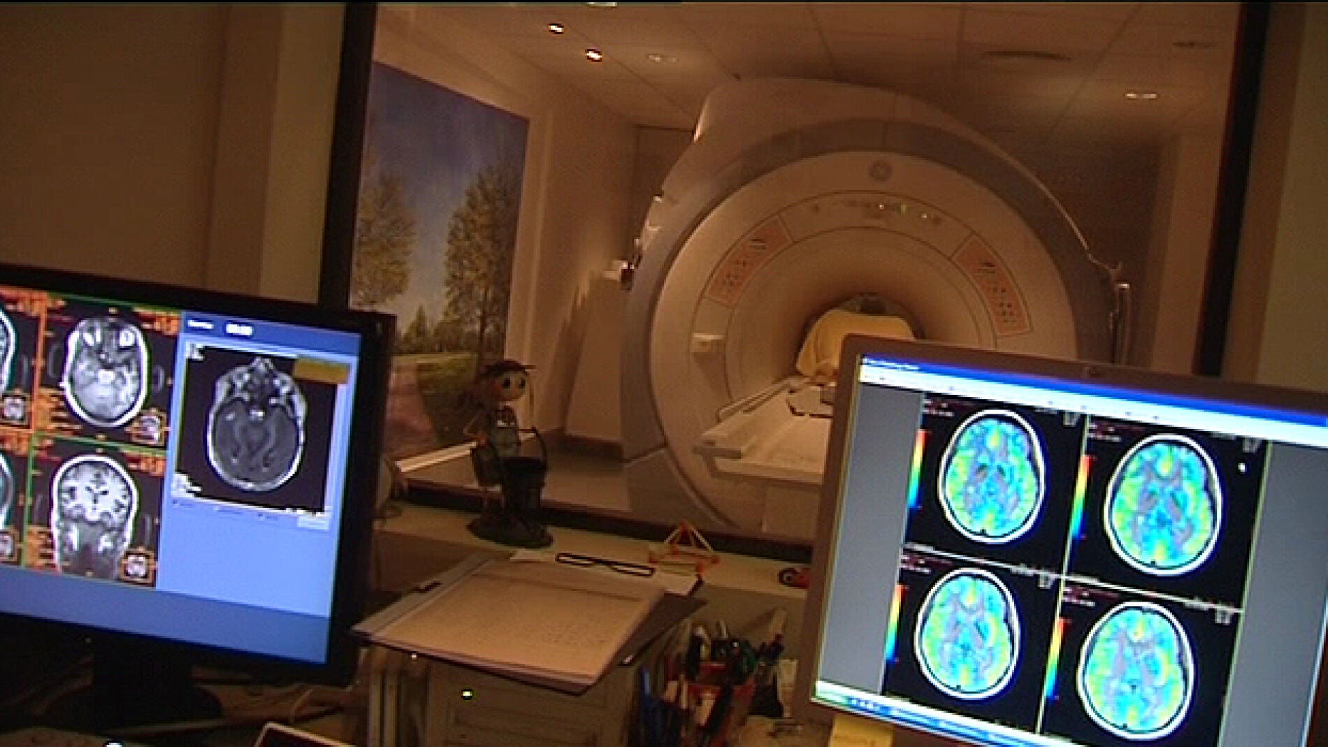 Pruebas para la detecci&oacute;n del Alzheimer.