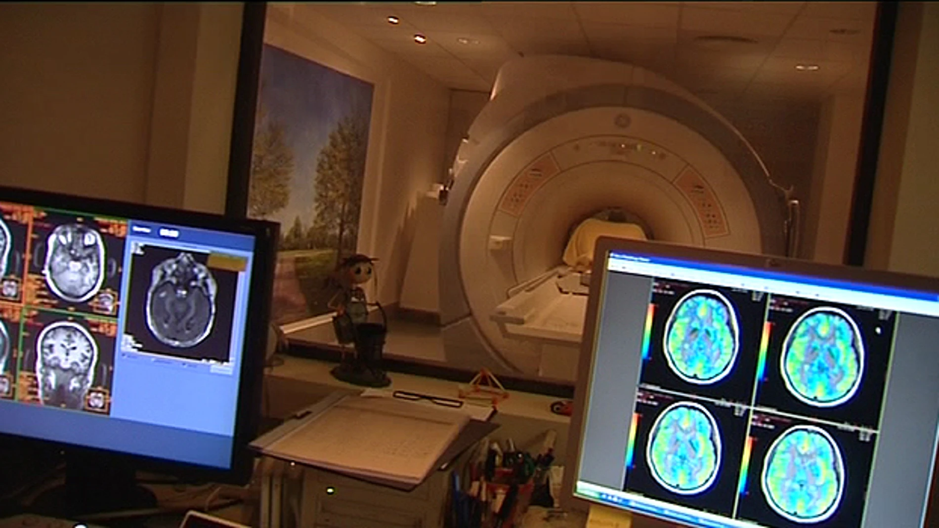 Pruebas para la detección del Alzheimer. Pruebas para la detección del Alzheimer.