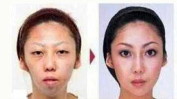 Antes y después de las operaciones de estética de la ex mujer de Jian Feng