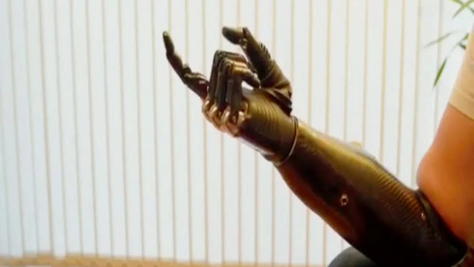 El brazo biónico ya es una realidad El brazo biónico ya es una realidad