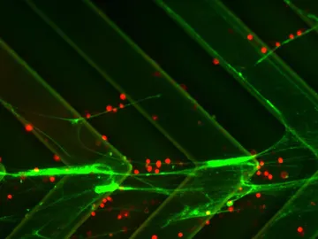 Células cancerígenas Células cancerígenas