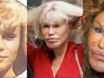 La dismorfofobia puede derivar en una adicción al bisturí La dismorfofobia puede derivar en una adicción al bisturí