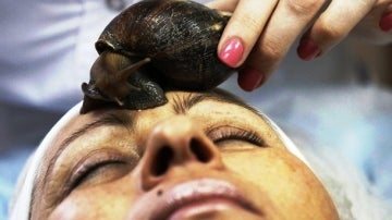 La baba de caracol regenera la piel
