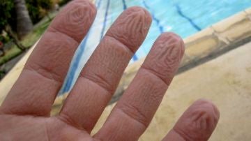 ¿Por qué se arrugan los dedos cuando se mojan?