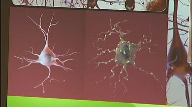 Investigadores españoles crean la primera vacuna contra el Alzheimer
