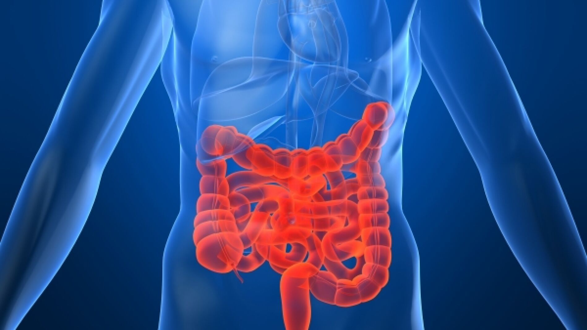 C&aacute;ncer de colon