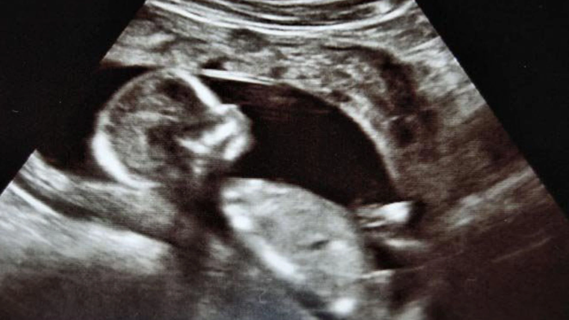 Una ecografía Una ecografía