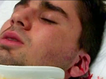 Agresión a un joven Agresión a un joven