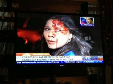 Imagen de la periodista agredida en Venezuela