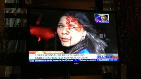 Imagen de la periodista agredida en Venezuela