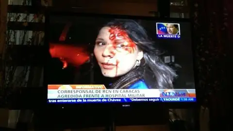 Imagen de la periodista agredida en Venezuela Imagen de la periodista agredida en Venezuela
