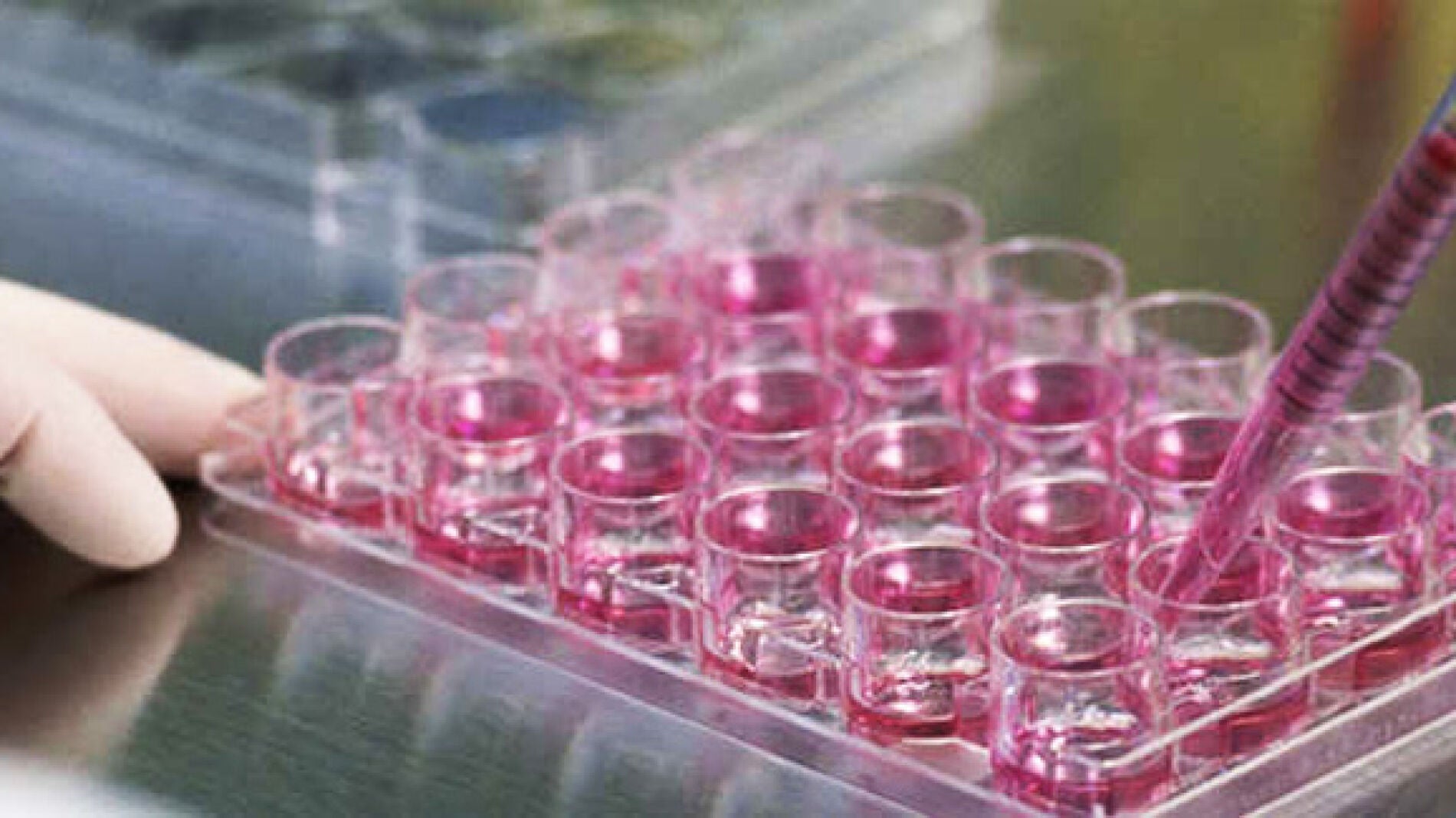 Terapia experimental con c&eacute;lulas afectadas.