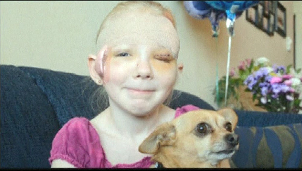 Un chihuahua salva a su dueña de 8 años del ataque de un pitbull