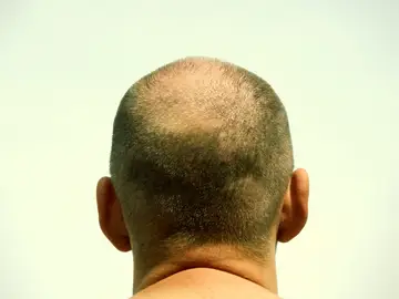 “Todo cambió cuando me hicieron una foto por detrás" “Todo cambió cuando me hicieron una foto por detrás"