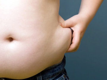 Sobrepeso en la zona abdominal
