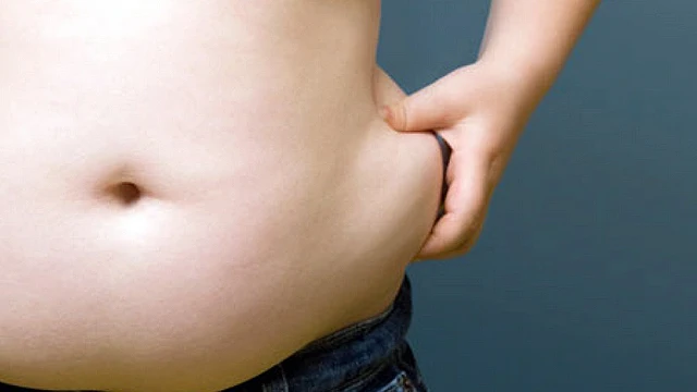 Sobrepeso en la zona abdominal Sobrepeso en la zona abdominal