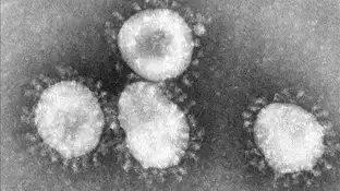 Imagen del coronavirus en el microscopio Imagen del coronavirus en el microscopio