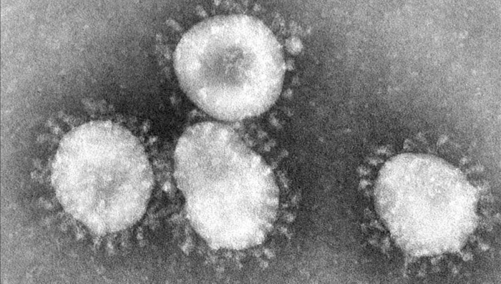 Imagen del coronavirus en el microscopio