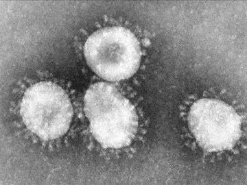 Imagen del coronavirus en el microscopio