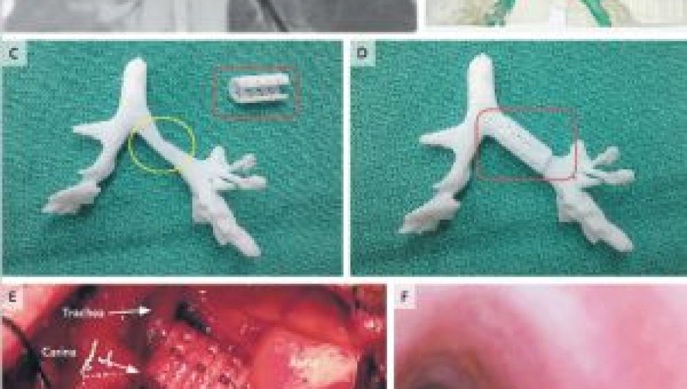 Imágenes de la pieza creada por la impresora 3D